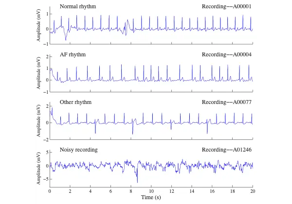 ECG AI Robustness